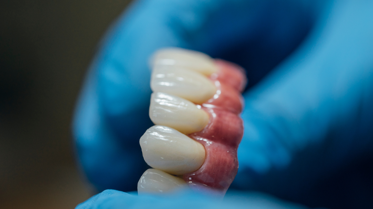 Tipos de próteses dentárias neste artigo da Implanto Clinic.